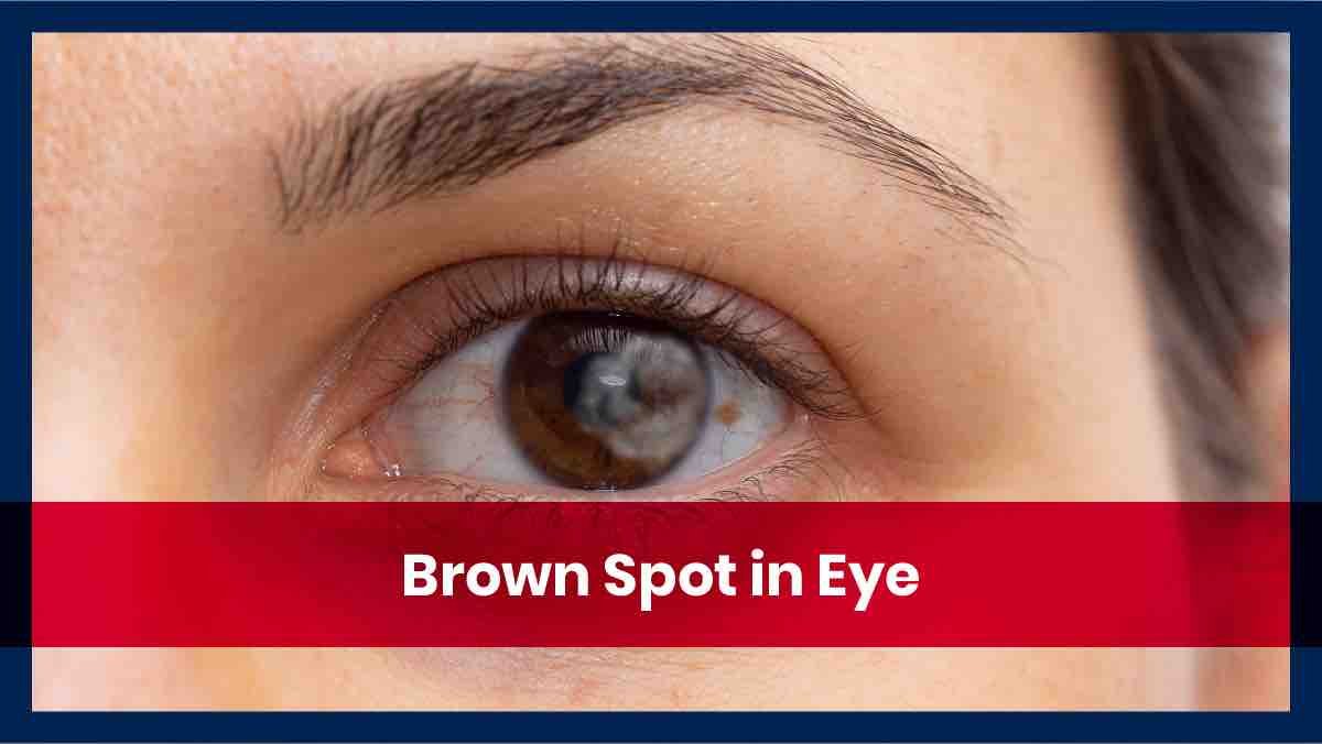 Black Spot in the Eye: Causes Symptoms and Treatment