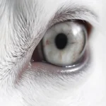 Black Spot in the White of the Eye: Causes Treatment and